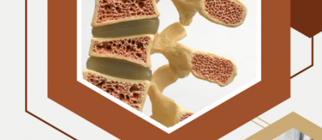 [:it]SIOMMMS INCONTRA SIN EMILIA ROMAGNA. VALUTAZIONE MULTIDISCIPLINARE DEL METABOLISMO MINERALE OSSEO NEL PAZIENTE NEFROPATICO[:]